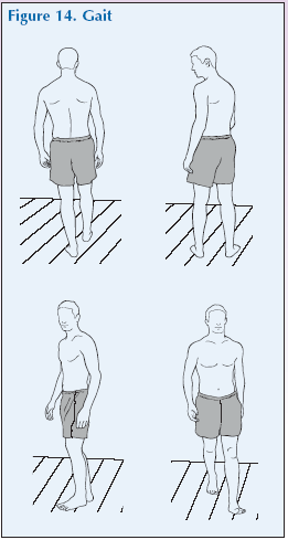 Demonstration - Global Alliance for Musculoskeletal Health